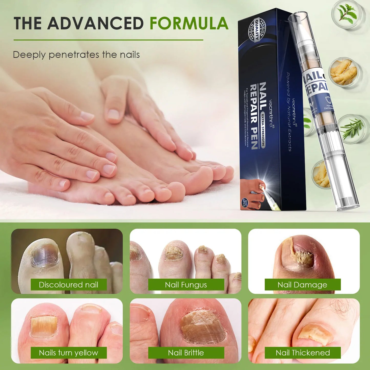 1 Box/4pcs Nail Fungal Liquid Fast Onychomycosis Fungus Nails